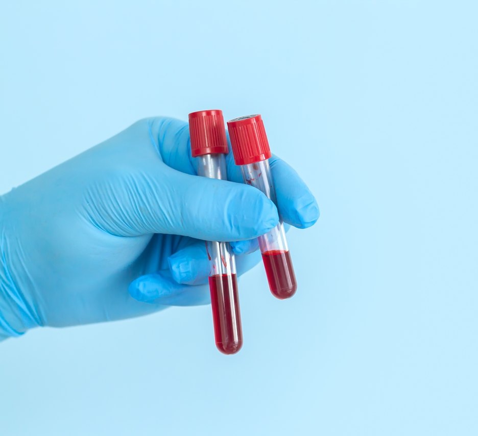 Blood diagnostics and biomarker testing at Nexora Health
